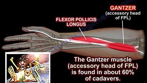 Gantzer Muscle Accessory Head FPL - Everything You...