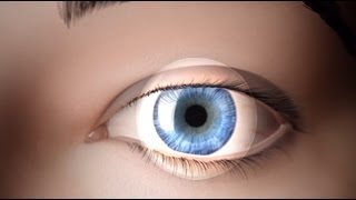Download lagu Photorefractive keratectomy PRK Photorefractive keratectomy PRK