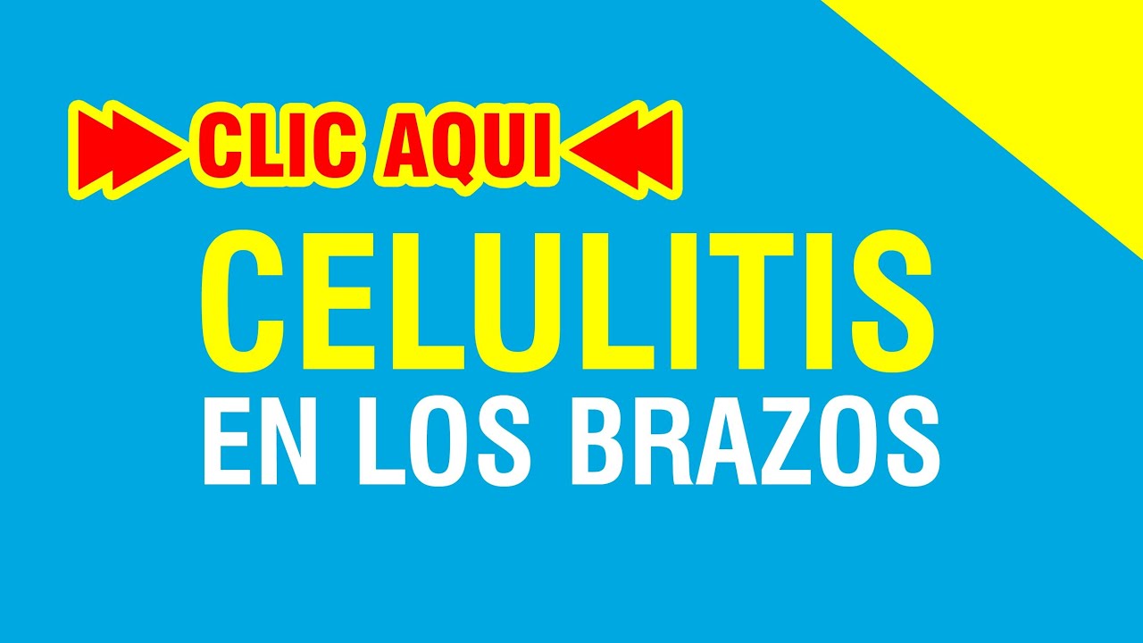 Celulitis en los Brazos Celulitis Como Eliminarla YouTube Celulitis en los Brazos Celulitis Como Eliminarla YouTube