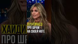 ⚡️Хайди Клум // про шрам на своей ноге. #heidiklum #хайдиклум