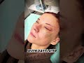 Tiny-incision lift for smooth definition and fresh glow. #MiniLift #glowup