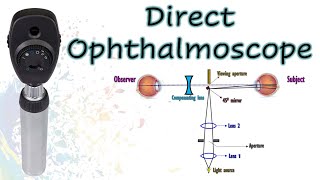 The Direct Ophthalmoscope | Know Your Instrument 1