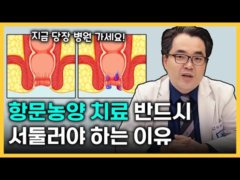 항문농양 치료는 늦을수록 안좋습니다!!  [#3 항문주위농양의 모든 것] 항문농양을 수술해야 하는 이유!!