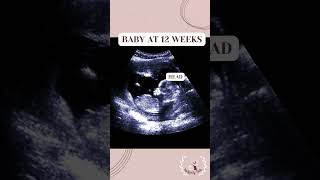 HEALTHY BABY ULTRASOUND, PREGNANCY! INFERTILITY, PREGNANT!  BABY #pregnancytips #shorts #ttc