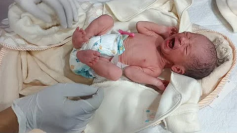 💕 From Delivery to NICU | First Assessment and Feeding Moment#newborncare #nicubaby 