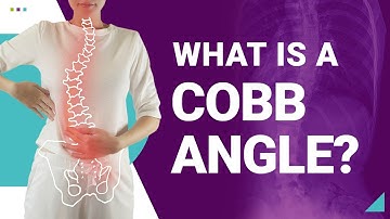 How Does a Cobb Angle Classify Scoliosis?