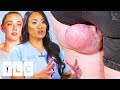 “I Don’t Want My Daughters To Be Like Me”: Lump Causes Extreme Anxiety To A Mum | Dr. Pimple Popper