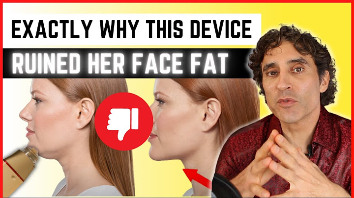 🛑 AVOID FACE FAT LOSS 🛑!!