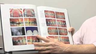 BI-Dimension TEchnique Theory and Practice