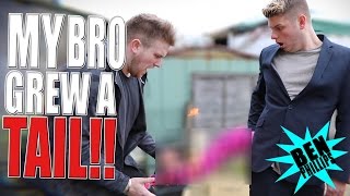 My bro has a rare growth! PRANK!