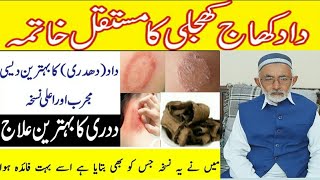 داد کا علاج/daad khaj khujli ka ilaj/treatment of ringworm on skin/fungal infection treatment