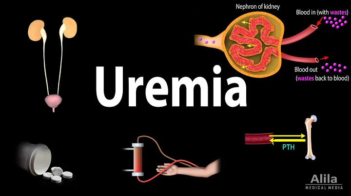 Uremia: Pathophysiology, Symptoms, Diagnosis and Treatment, Animation - DayDayNews