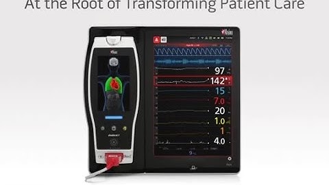 Patient Monitoring and Connectivity Platform to Transform Care - Masimo Root® and Trade
