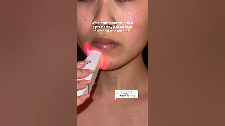 Finally trying an LED pen for my hormonal acne??! 🫣 #acneproneskin #ledtherapy #ledlighttherapy
