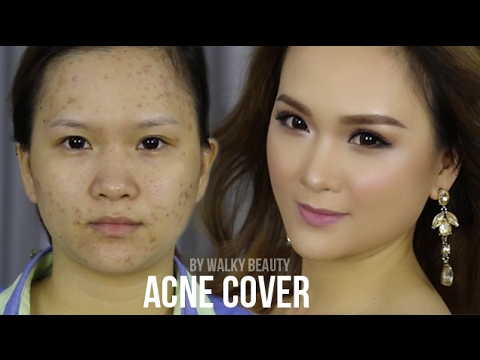 Trang Điểm Da Mụn - Acnes Cover Makeup by Walky Beauty