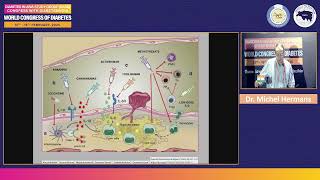 World Congress of Diabetes 2025 | Dr. Michel Hermans | Day 1 | Macleod Hall