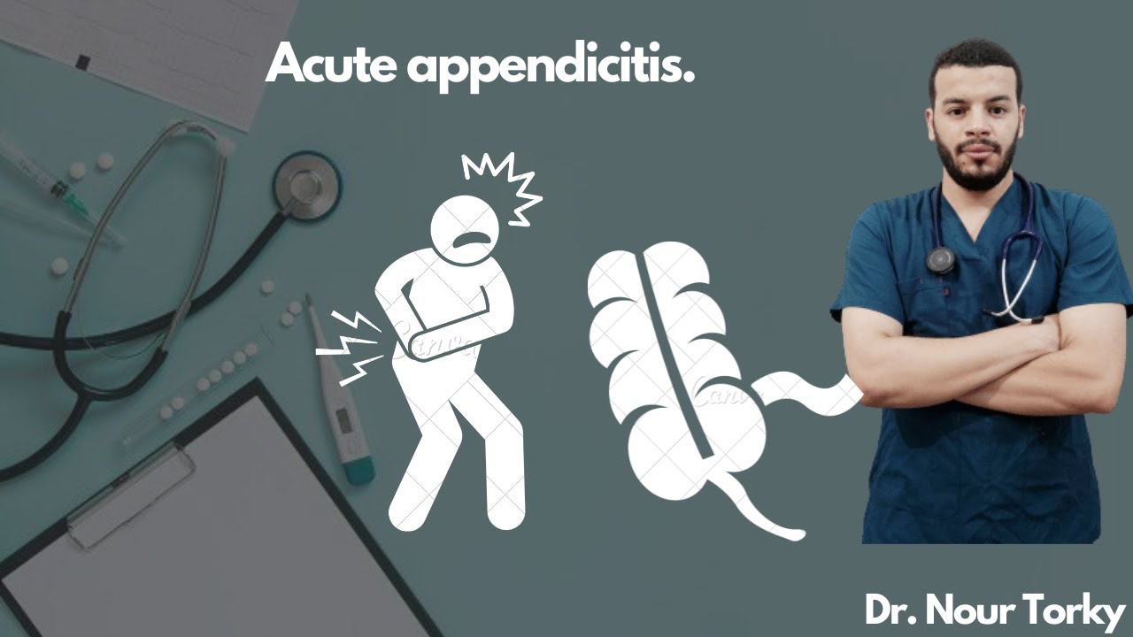 8-Acute appendicitis