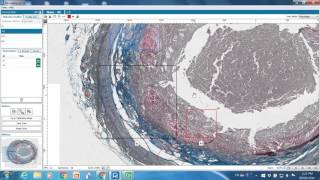 Training: Multi-objective scanning and Z-stacking