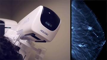 Hologic Streamlines Trade Compliance with Oracle GTM Cloud