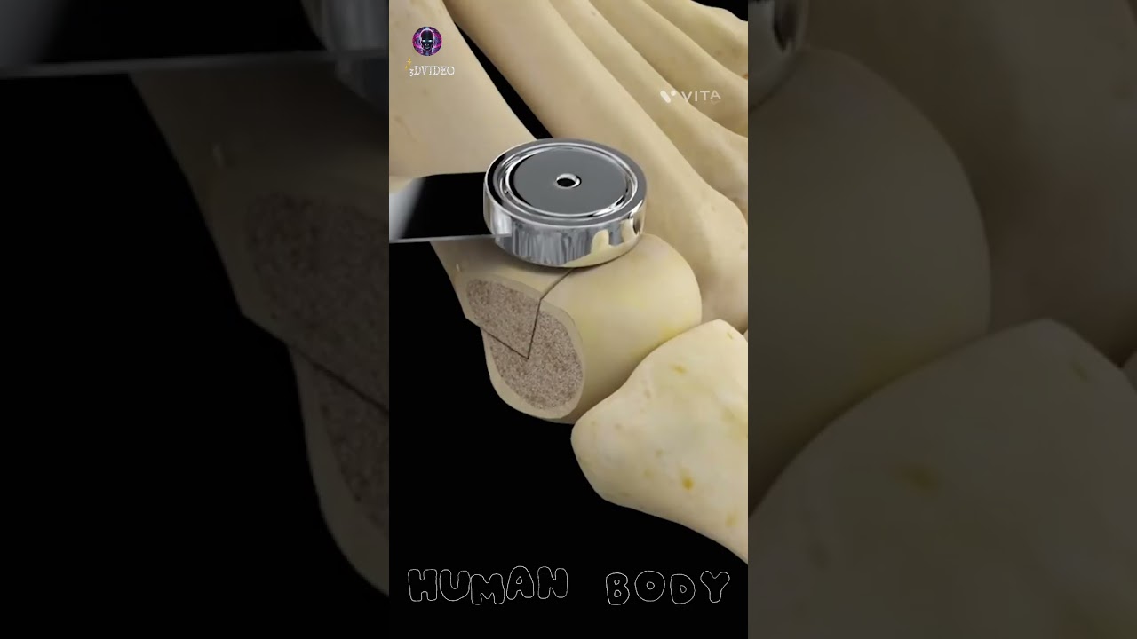 Start exploring a suite of 3D procedure video in complete anatomy
