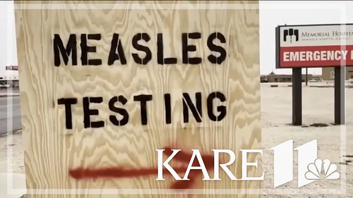 Knowing the warning signs of measles