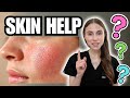Dermatologist Q&amp;A: Everyday Skin Problems Explained