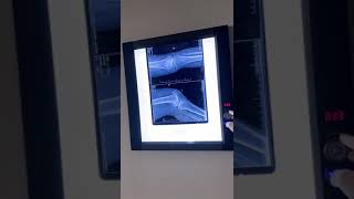 X-ray film viewer