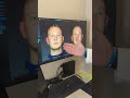 3D Rhinoplasty Simulation