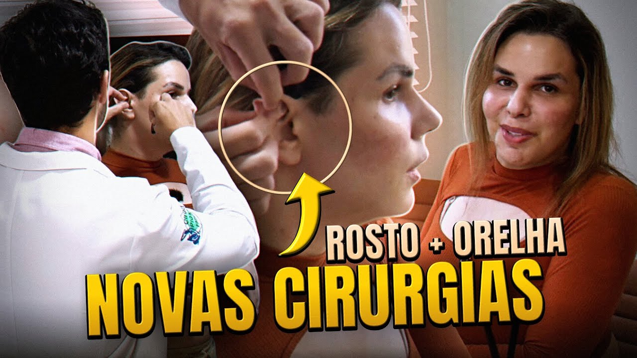 Farei RINOPLASTIA, OTOPLASTIA e outros PROCEDIMENTOS 👃👂