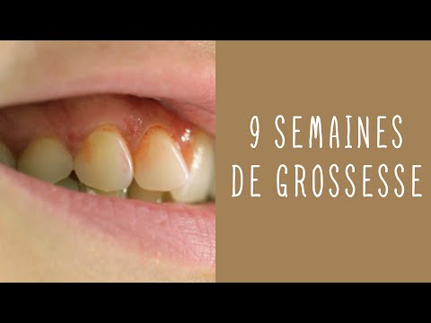 Vidéo: À 9 semaines de grossesse, des symptômes ?