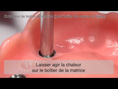 Novaloc extracteur de boîtier de matrice_FR