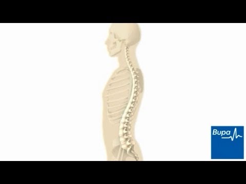 How to improve your posture