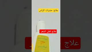 علاج حشرات الراس علاج قمل الشعر