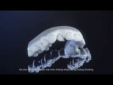 Video Tại Sao Nên Lựa Chọn Niềng Răng Trong Suốt Invisalign? - youtube