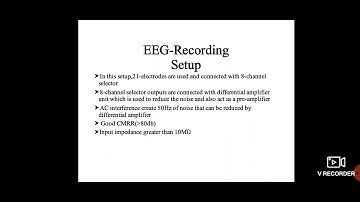 ecg recording setup