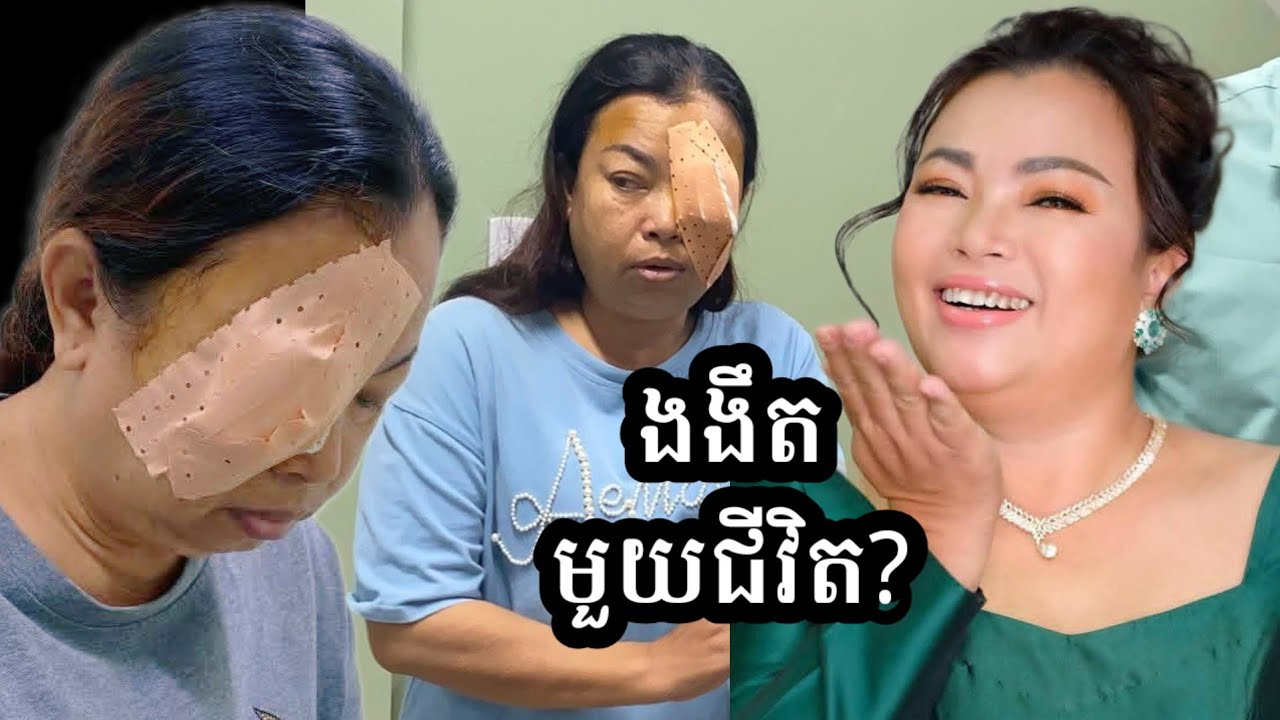 លាក់យូរហើយ  អ្នកនាង ប៉េងប៉ោង បង្ហាញពីស្ថានភាពភ្នែក