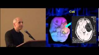 Dr. Daniel Amen | Brain SPECT Imaging - Psychiatry's Tool to Save Lives