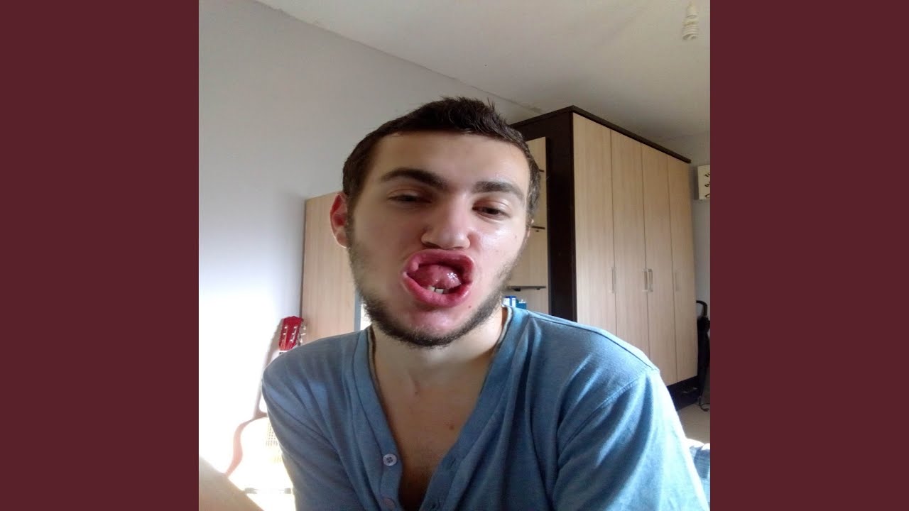 Guarda Dabada su YouTube Guarda Dabada su YouTube