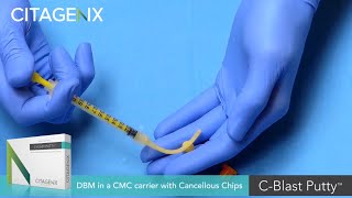Bone Graft - DBM with Cancellous Chips in a CMC carrier [C-Blast Putty] Unboxing | Citagenix