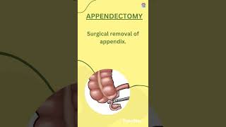 CHOLECYSTECTOMY and APPENDECTOMY