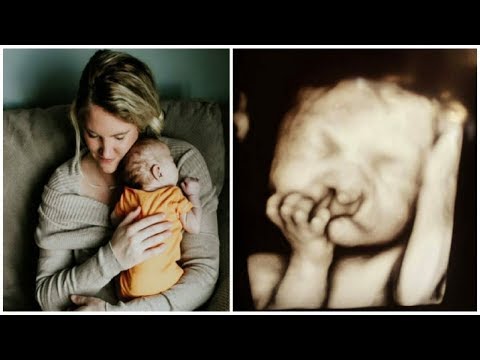 parents-refuse-to-have-abortion,-3-months-later-mom-discovers-something-that-brings-her-to-tears