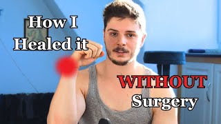 TFCC Tear Destroyed My Wrist – Then I Did This