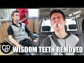 "MY TONGUE FELL OUT" | GETTING MY WISDOM TEETH REMOVED | HE GOT HIS WISDOM TEETH OUT with ANESTHESIA