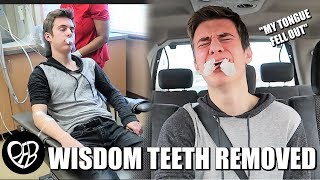 'MY TONGUE FELL OUT' | GETTING MY WISDOM TEETH REMOVED | HE GOT HIS WISDOM TEETH OUT with ANESTHESIA