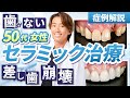 差し歯崩壊して歯がない状態の50台女性をセラミック治療でお悩み解決【症例解説】