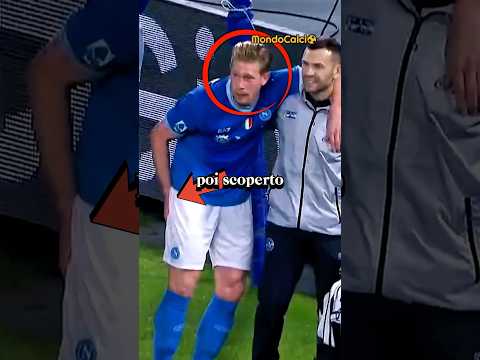 Video Come De Bruyne ha tirato un rigore così forte da procurarsi un infortunio di 3 mesi. ??