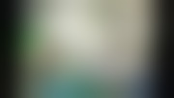 Complete Mesocolic Excision Fluorescence-Guided - Colon Cancer