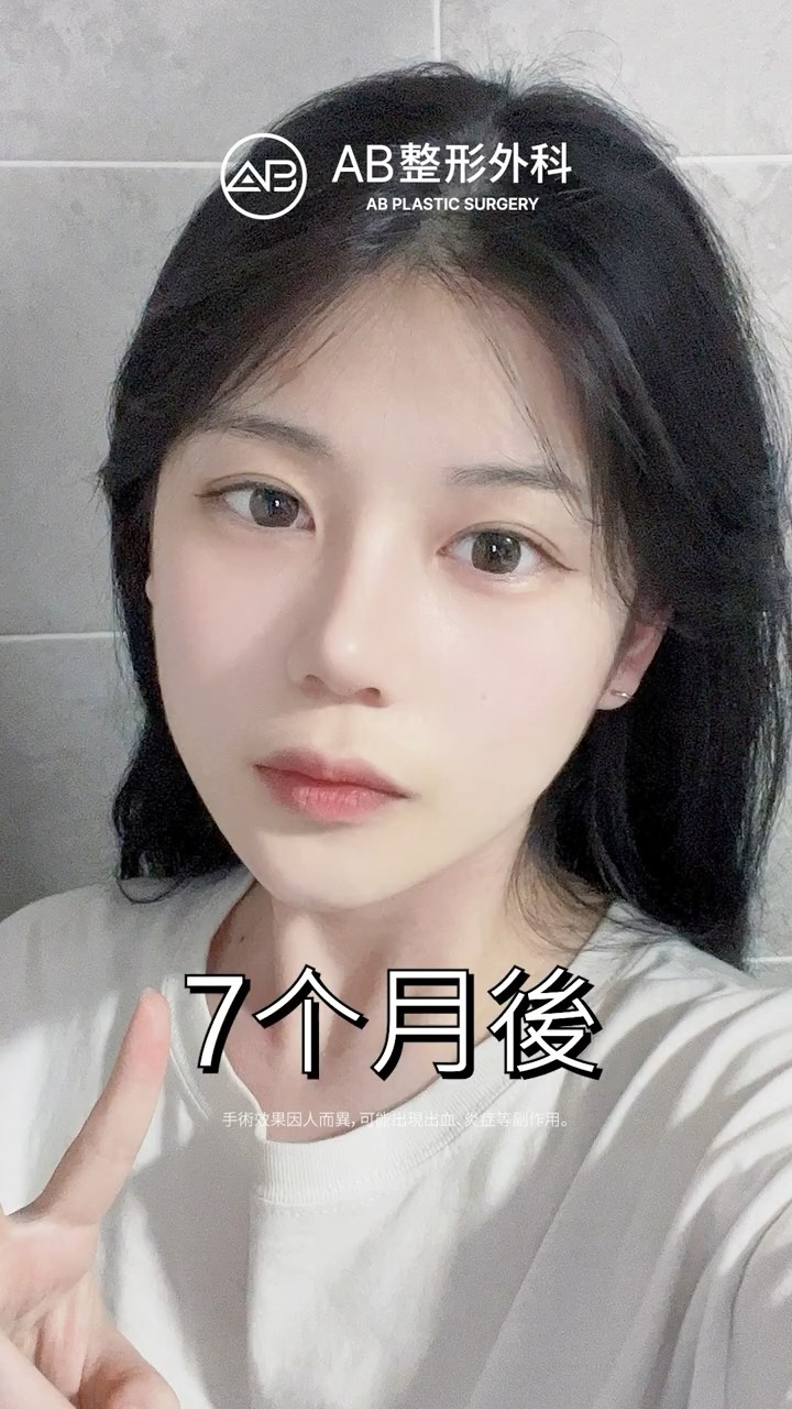 輪廓三件套＋鼻整形，變美不只一個地方🤍 #Shorts