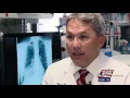 MRSA PNEUMONIA 
