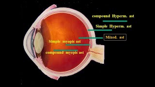 011 optics course (new 2020) :  astigmatism